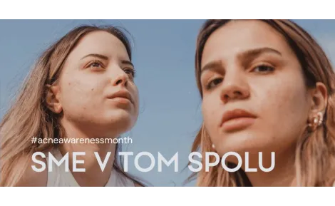 Sme v tom spolu