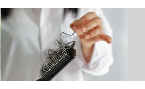 Vypadávanie vlasov? Príčiny, prevencia a tipy pre zdravé vlasy