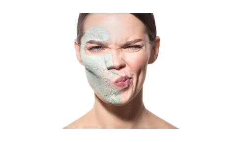 Čierne bodky - problém, ktorý trápi väčšinu z nás