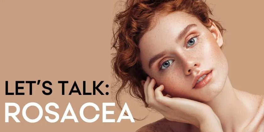 Lets talk: Rosacea