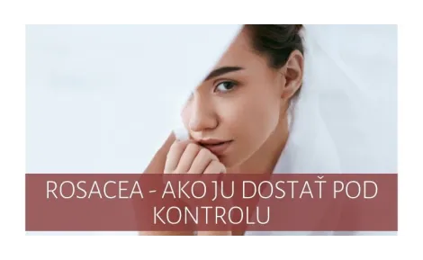 Rosacea - ako ju dostať pod kontrolu