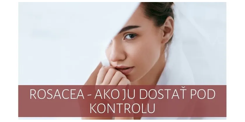 Rosacea - ako ju dostať pod kontrolu